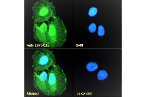 Immunofluorescence (IF) image for anti-Erythrocyte Membrane Protein Band 4.1 Like 5 (EPB41L5) (Internal Region) antibody (ABIN238631)