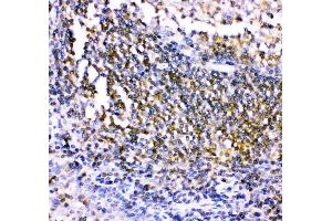 IHC analysis of CSK using anti-CSK antibody (ABIN3042764).