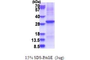 SDS-PAGE (SDS) image for Kallikrein 10 (KLK10) (AA 34-276) protein (His tag) (ABIN5853683) (Kallikrein 10 Protein (KLK10) (AA 34-276) (His tag))