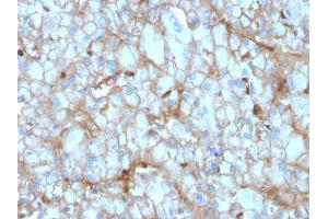 Formalin-fixed, paraffin-embedded human Kidney stained with C1QA Mouse Monoclonal Antibody (C1QA/2954). (C1QA Antikörper  (AA 104-237))