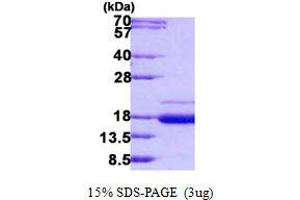 Image no. 1 for Signal Sequence Receptor, beta (Translocon-Associated Protein Beta) (SSR2) protein (His tag) (ABIN1098556)