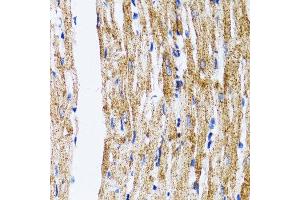 Immunohistochemistry of paraffin-embedded mouse heart using MAP1LC3B antibody. (LC3B Antikörper)