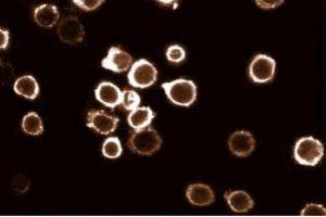 Immunofluorescent staining of HL60 cells with anti-HS1 antibody.