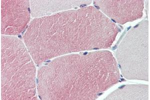 Anti-TXLNB antibody  ABIN1049448 IHC staining of human skeletal muscle. (Taxilin beta Antikörper  (Internal Region))