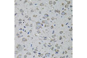 Immunohistochemistry of paraffin-embedded mouse brain using IL1A antibody (ABIN6291332) at dilution of 1:100 (40x lens). (IL1A Antikörper)