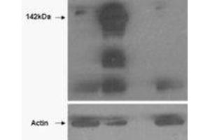 Western Blotting (WB) image for anti-Tankyrase, TRF1-Interacting Ankyrin-Related ADP-Ribose Polymerase (TNKS) (N-Term) antibody (ABIN2464160) (TNKS Antikörper  (N-Term))