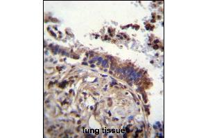 TTBK2 Antibody (N-term) (ABIN656096 and ABIN2845439) immunohistochemistry analysis in formalin fixed and paraffin embedded human lung tissue followed by peroxidase conjugation of the secondary antibody and DAB staining. (TTBK2 Antikörper  (N-Term))