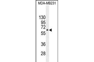 HNF1B Antibody (C-term) (ABIN655066 and ABIN2844696) western blot analysis in MDA-M cell line lysates (35 μg/lane). (HNF1B Antikörper  (C-Term))