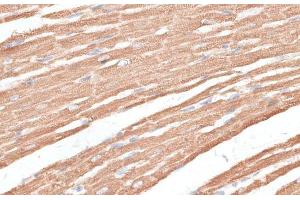 Immunohistochemistry of paraffin-embedded Rat heart using KIF4A Polyclonal Antibody at dilution of 1:100 (40x lens).