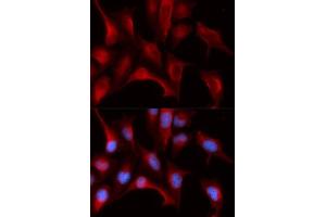 Immunofluorescence analysis of U2OS cells using PSMB4 antibody. (PSMB4 Antikörper  (AA 1-264))