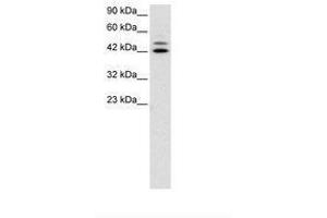 Image no. 3 for anti-Interferon Regulatory Factor 8 (IRF8) (AA 35-84) antibody (ABIN6735806) (IRF8 Antikörper  (AA 35-84))