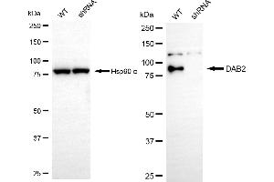 Western blotting analysis using DAB2 antibody (ABIN7798352). (Rekombinanter DAB2 Antikörper)