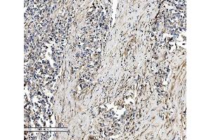 IHC analysis of SEC14L3/TAP2 using anti-SEC14L3/TAP2 antibody (ABIN7601623). (SEC14L3 Antikörper  (AA 4-400))