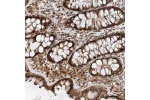Immunohistochemical staining of human colon with TATDN3 polyclonal antibody  shows strong nuclear, cytoplasmic and membranous positivity in glandular cells. (TATDN3 Antikörper)