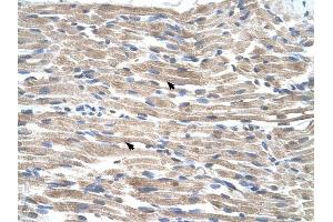 BMP2K antibody was used for immunohistochemistry at a concentration of 4-8 ug/ml to stain Skeletal muscle cells (arrows) in Human Muscle.
