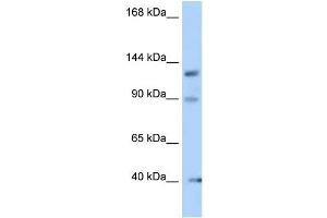 WB Suggested Anti-Ofd1 Antibody Titration: 1. (OFD1 Antikörper  (N-Term))