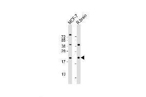 Western Blot at 1:2000 dilution Lane 1: MCF-7 whole cell lysate Lane 2: rat brain lysate Lysates/proteins at 20 ug per lane. (RAC1 Antikörper  (AA 49-78))