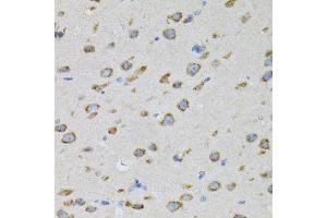Immunohistochemistry of paraffin-embedded mouse brain using NAPA antibody. (NAPA Antikörper)