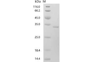 (Tris-Glycine gel) Discontinuous SDS-PAGE (reduced) with 5 % enrichment gel and 15 % separation gel.
