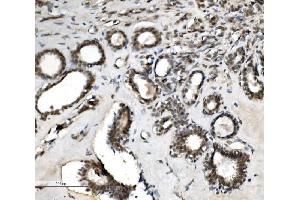 IHC analysis of VPRBP/DCAF1 using anti-VPRBP/DCAF1 antibody (ABIN7599063). (DDB1 and CUL4-Associated Factor 1 (DCAF1) (AA 1-195) Antikörper)