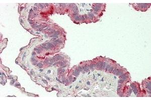 Immunohistochemistry (IHC) image for anti-Folate Receptor 1 (Adult) (FOLR1) (AA 25-234) antibody (ABIN7436045)