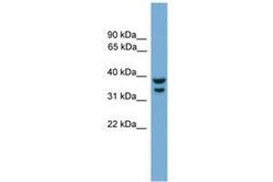 Image no. 1 for anti-Interferon Regulatory Factor 1 (IRF1) (AA 251-300) antibody (ABIN6744534) (IRF1 Antikörper  (AA 251-300))