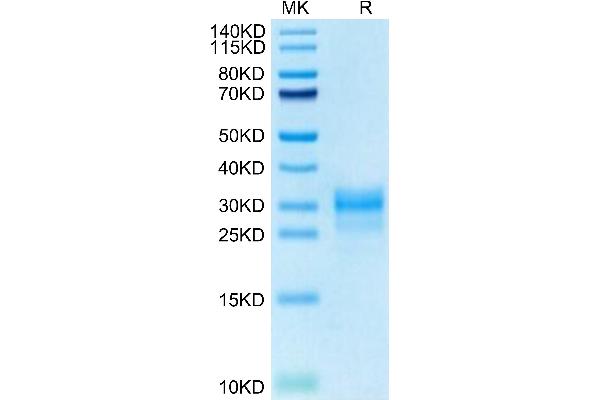 IL1A Protein (AA 113-271) (His tag)