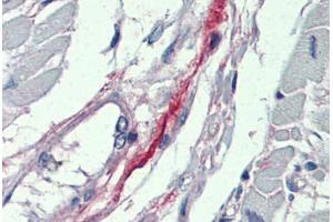 Heart, Human: Formalin-Fixed, Paraffin-Embedded (FFPE) (DDAH2 Antikörper  (N-Term))