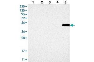 Western blot analysis of Lane 1: RT-4, Lane 2: U-251 MG, Lane 3: Human Plasma, Lane 4: Liver, Lane 5: Tonsil with MFSD6L polyclonal antibody . (MFSD6L Antikörper)