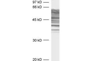 Western Blotting (WB) image for anti-tau Protein (AA 3-214) antibody (ABIN1742569) (tau Antikörper  (AA 3-214))