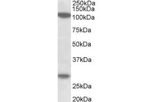 ABIN5539532 (1µg/ml) staining of MOLT4 lysate (35µg protein in RIPA buffer). (Ubinuclein 1 Antikörper  (Internal Region))