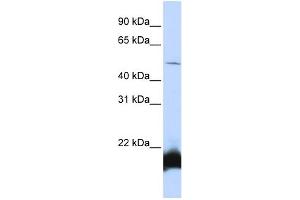 WB Suggested Anti-ONECUT1 Antibody Titration:  0. (ONECUT1 Antikörper  (N-Term))