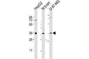 All lanes : Anti-CRYZ Antibody (C-term) at 1:2000 dilution Lane 1: HepG2 whole cell lysates Lane 2: mouse brain lysates Lane 3: U-87-MG whole cell lysates Lysates/proteins at 20 μg per lane.