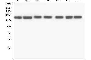 Western blot analysis of RNF123 using anti-RNF123 antibody (ABIN6719387).
