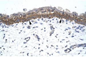 Human Skin (ZNF385A Antikörper  (C-Term))