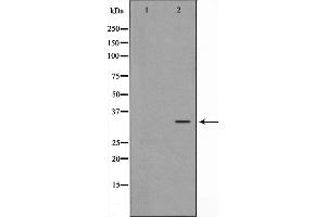Western blot analysis on HepG2 cell lysate using MAGE-1 Antibody,The lane on the left is treated with the antigen-specific peptide.