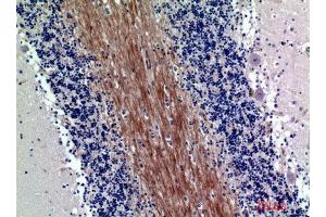 Immunohistochemistry (IHC) analysis of paraffin-embedded Human Brain, antibody was diluted at 1:200. (SIRP-Alpha1/beta1 (Internal Region) Antikörper)