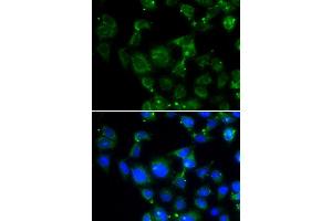 Immunofluorescence analysis of HeLa cell using MAPRE2 antibody. (MAPRE2 Antikörper)
