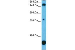 Host:  Rabbit  Target Name:  PLCG1  Sample Type:  PANC1 Whole Cell  Antibody Dilution:  1. (Phospholipase C gamma 1 Antikörper  (C-Term))
