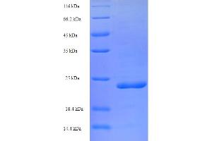SDS-PAGE (SDS) image for Peptidase Inhibitor 3, Skin-Derived (PI3) (AA 61-117) protein (His-SUMO Tag) (ABIN5710095) (PI3 Protein (AA 61-117) (His-SUMO Tag))