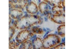 Used in DAB staining on fromalin fixed paraffin-embedded Kidney tissue (HMOX2 Antikörper  (AA 71-306))