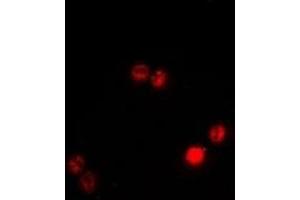 Immunofluorescent analysis of BAF53B staining in A549 cells. (Actin-Like 6B Antikörper)