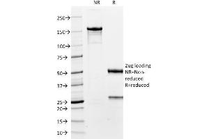 SDS-PAGE Analysis Purified TTF-1 Mouse Monoclonal Antibody (8G7G3/1). (NKX2-1 Antikörper)