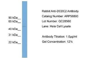 WB Suggested Anti-DCDC2  Antibody Titration: 0. (DCDC2 Antikörper  (Middle Region))