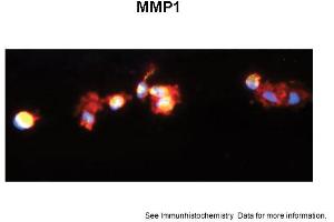 Sample Type: Human Macrophange CellsGreen: primaryRed: phallodinBlue: DAPIYellow: green/redPrimary Dilution: 1:200Secondary Antibody: anti-Rabbit IgG-FITCSecondary Dilution: 1:1000Image Submitted By: Milan FialaUniversity of California, Los Angeles (MMP1 Antikörper  (C-Term))