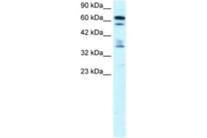 Western Blotting (WB) image for anti-Zinc Finger Protein 512 (ZNF512) antibody (ABIN2460159) (ZNF512 Antikörper)