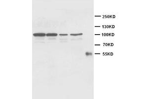 Western Blotting (WB) image for anti-Cadherin 2 (CDH2) antibody (ABIN1105630) (N-Cadherin Antikörper)