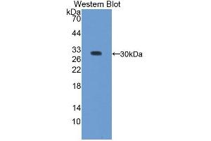 Western blot analysis of the recombinant protein. (Regucalcin Antikörper  (AA 65-299))