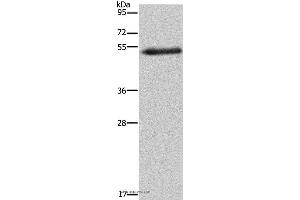 Western blot analysis of Human breast infiltrative duct tissue, using FOXC2 Polyclonal Antibody at dilution of 1:733 (FOXC2 Antikörper)