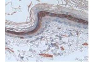 IHC-P analysis of Rat Skin Tissue, with DAB staining. (Involucrin Antikörper  (AA 461-551))